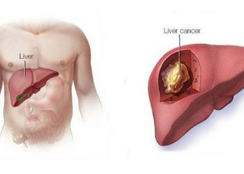 Dưỡng gan đúng hay sai đều bắt đầu từ việc ăn uống, đây là 4 việc bác sĩ rất tán thành