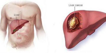 Dưỡng gan đúng hay sai đều bắt đầu từ việc ăn uống, đây là 4 việc bác sĩ rất tán thành
