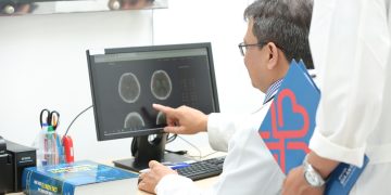 ĐIỀU TRỊ TIÊU SỢI HUYẾT ĐƯỜNG ĐỘNG MẠCH CỨU NGƯỜI BỆNH ĐỘT QUỴ ĐẾN SAU “GIỜ VÀNG”