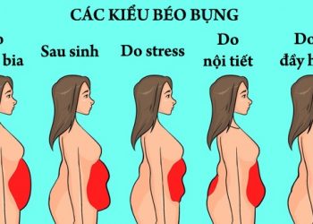 Các dạng bụng mỡ khó giảm, nguyên nhân và cách khắc phục